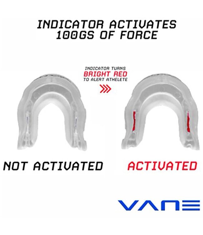 Vane Mouth Guard