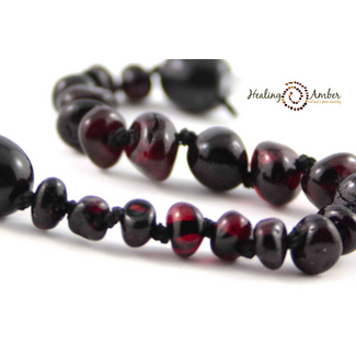 Healing Amber Healing Amber 11 inch Necklace Molasses Circle