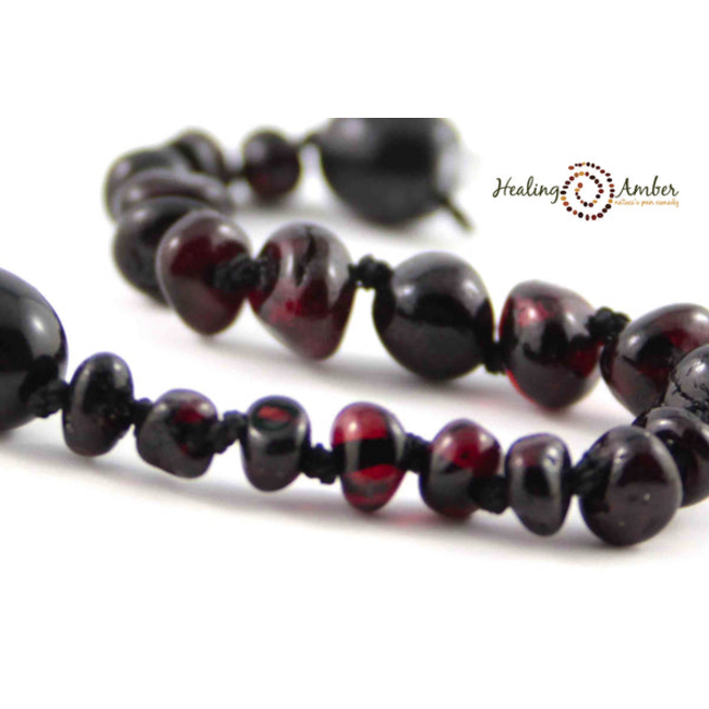 Healing Amber Healing Amber 11 inch Necklace Molasses Circle