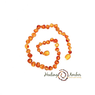 Healing Amber Healing Amber 15 inch Necklace Raw Caramel