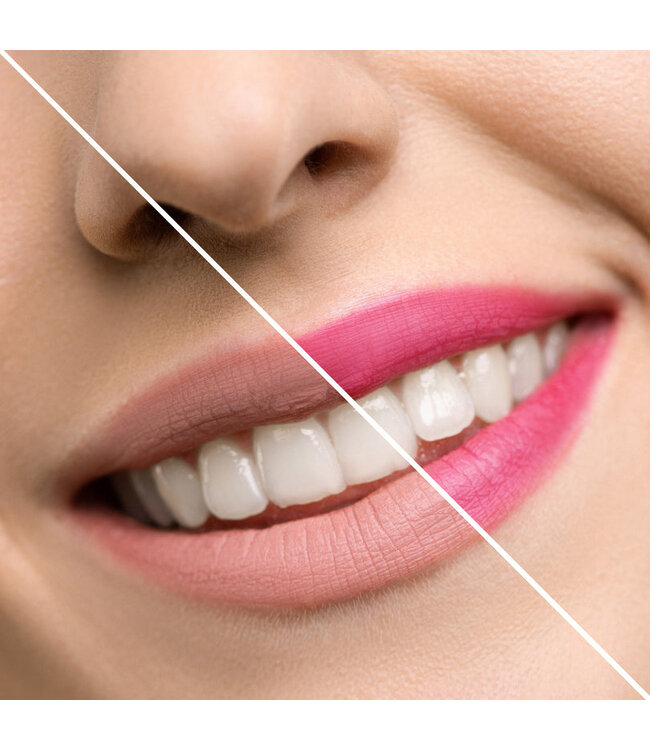 INUWET ROUGE À LÈVRES BRILLANTS - FLOWER IN A BOX ( MYRTILLE )