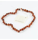 Canyon Leaf Baltic Amber 13" Necklace (Polished) - Cognac