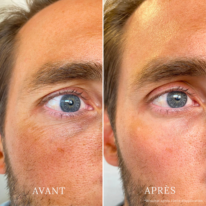 Patchs hydrogel éclat contour des yeux - 1 paire