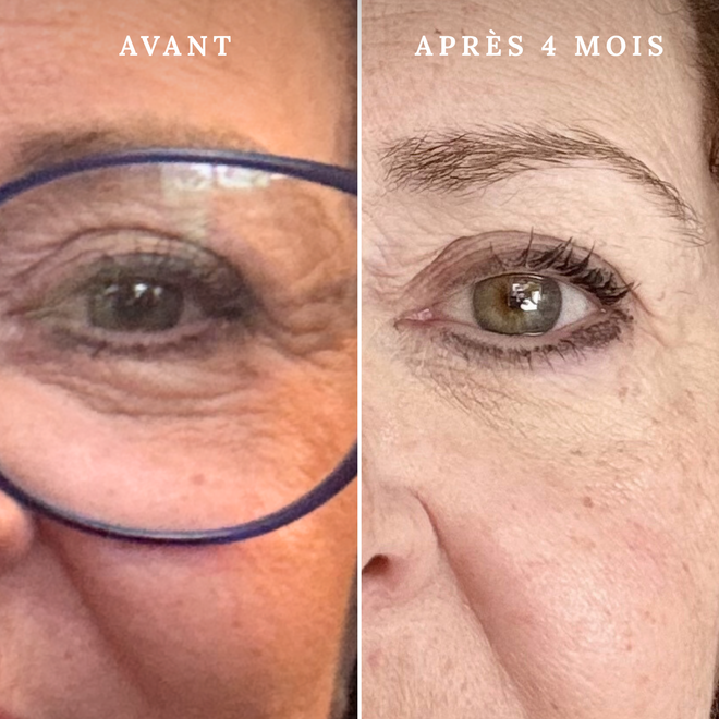 Masque LED de luminothérapie anti-âge - Rose