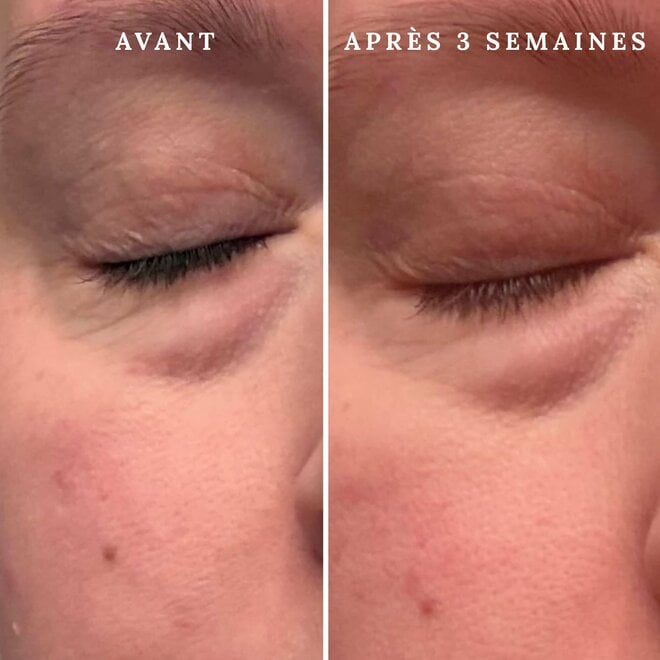 Masque LED pour le visage - Rose