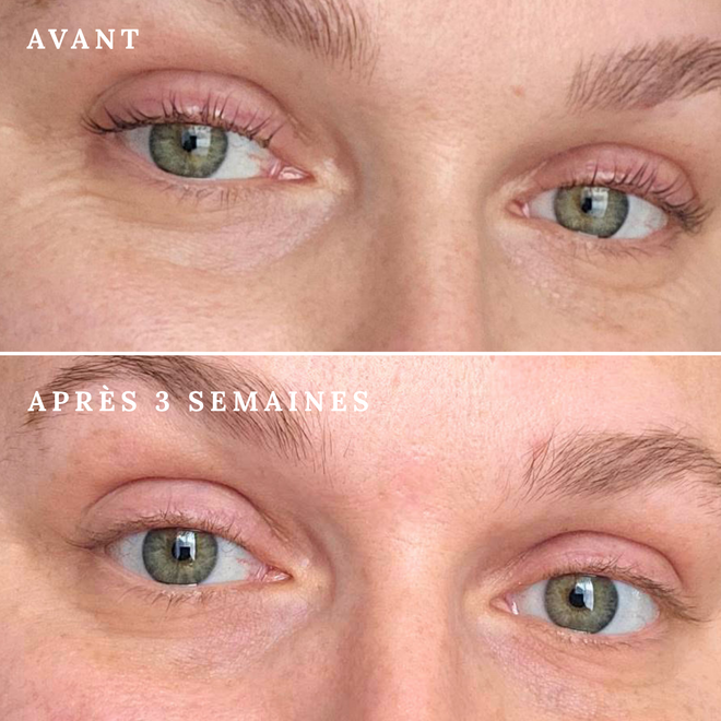 Masque LED pour le visage - Rose