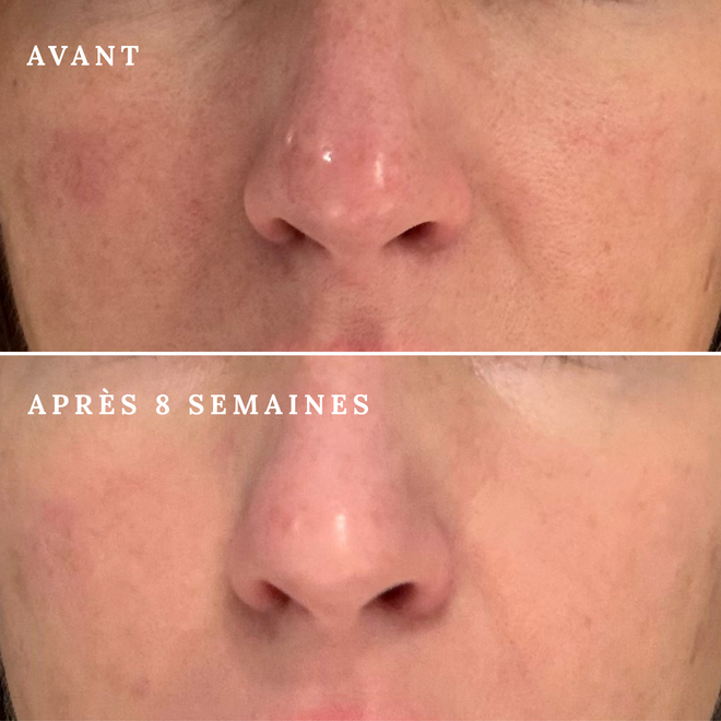 Masque LED pour le visage - Beige