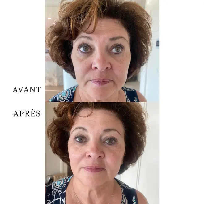 Masque liftant et raffermissant Celestial Black Diamond