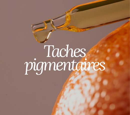 Taches pigmentaires