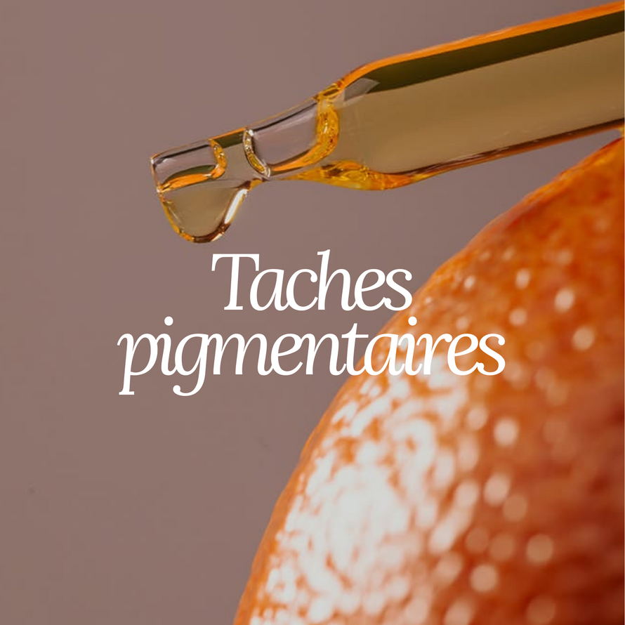 Taches pigmentaires
