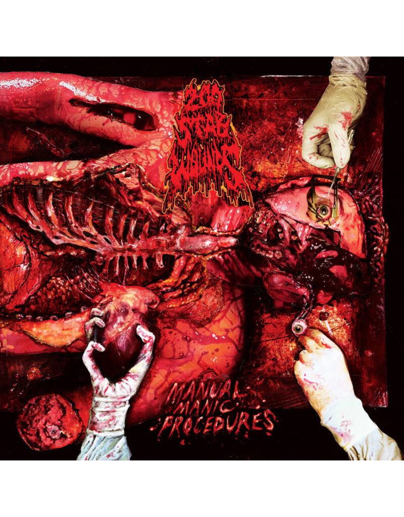 (LP) 200 Stab Wounds - Manual Manic Procedures