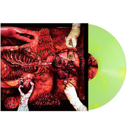 (LP) 200 Stab Wounds - Manual Manic Procedures (Ltd Coloured Vinyl)