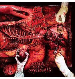 (LP) 200 Stab Wounds - Manual Manic Procedures (Limited Coloured Vinyl)