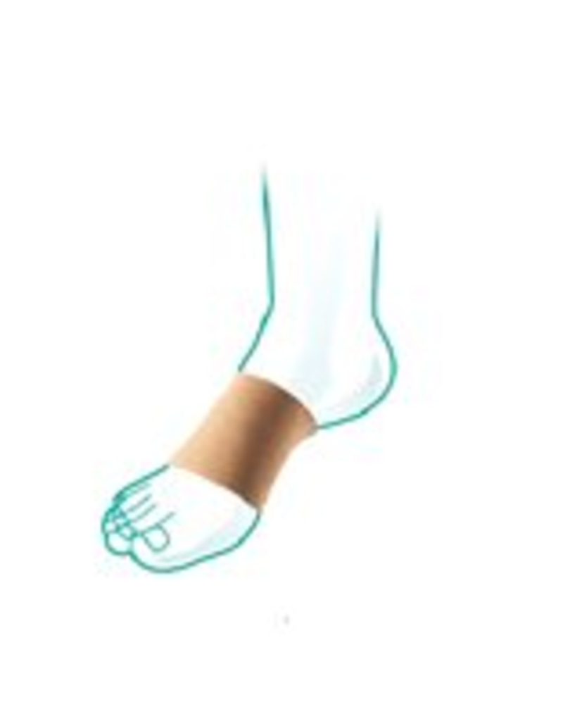 OppO Oppo Arch Bandage