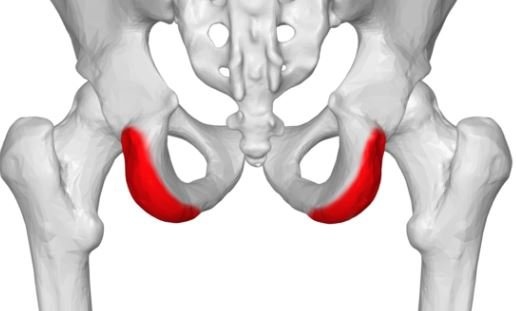 Cyclist Saddle Issues 