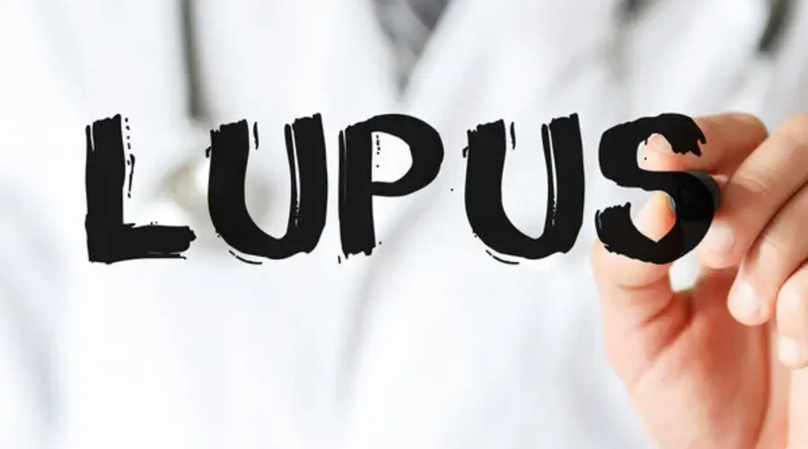 Mediterranean Diet Benefits Patients With Lupus, Study Suggests