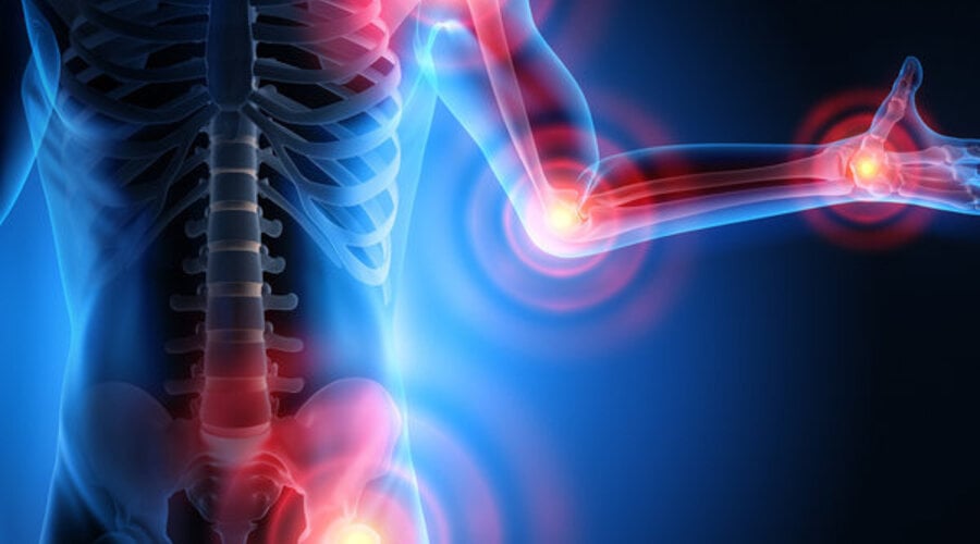 Oleocanthal in Extra Virgin Olive Oil: The Connection to Inflammation