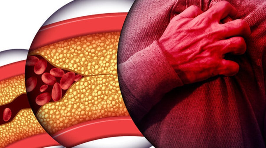 Olive Oil Compounds and Heart Metabolism: What an Animal Study Found