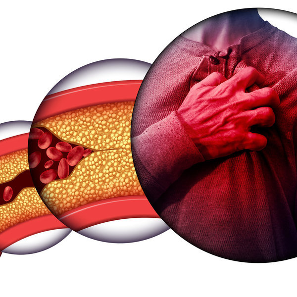 Olive Oil Compounds and Heart Metabolism: What an Animal Study Found