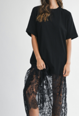 Oversized Lace Dress
