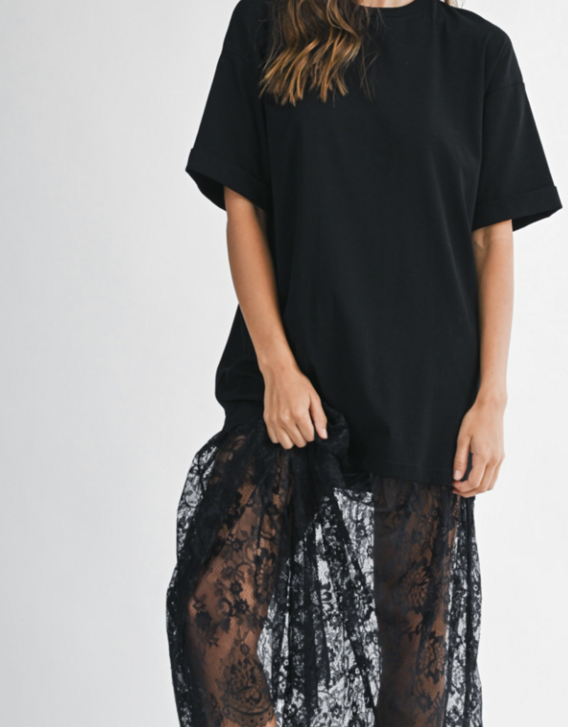 Oversized Lace Dress