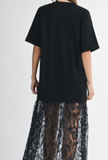 Oversized Lace Dress