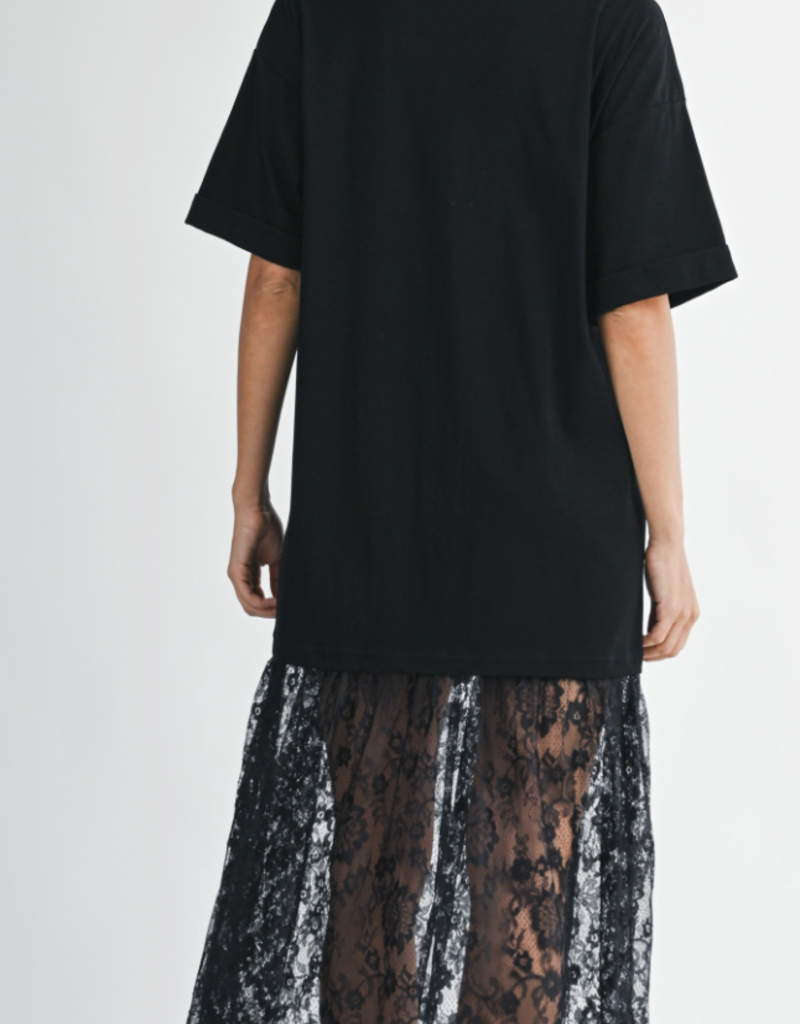 Oversized Lace Dress