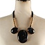 Up Top Stone Necklace Set - Black