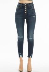 High Rise 5 Button Distressed Knee