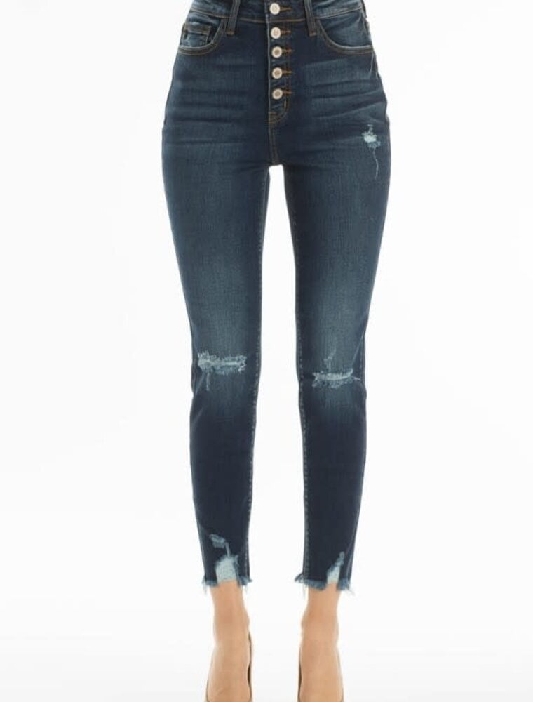 High Rise 5 Button Distressed Knee