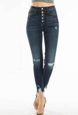 High Rise 5 Button Distressed Knee