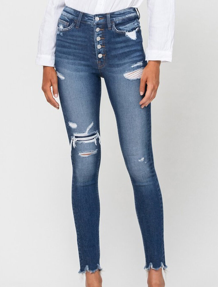 Parkside High Rise Distressed Skinny