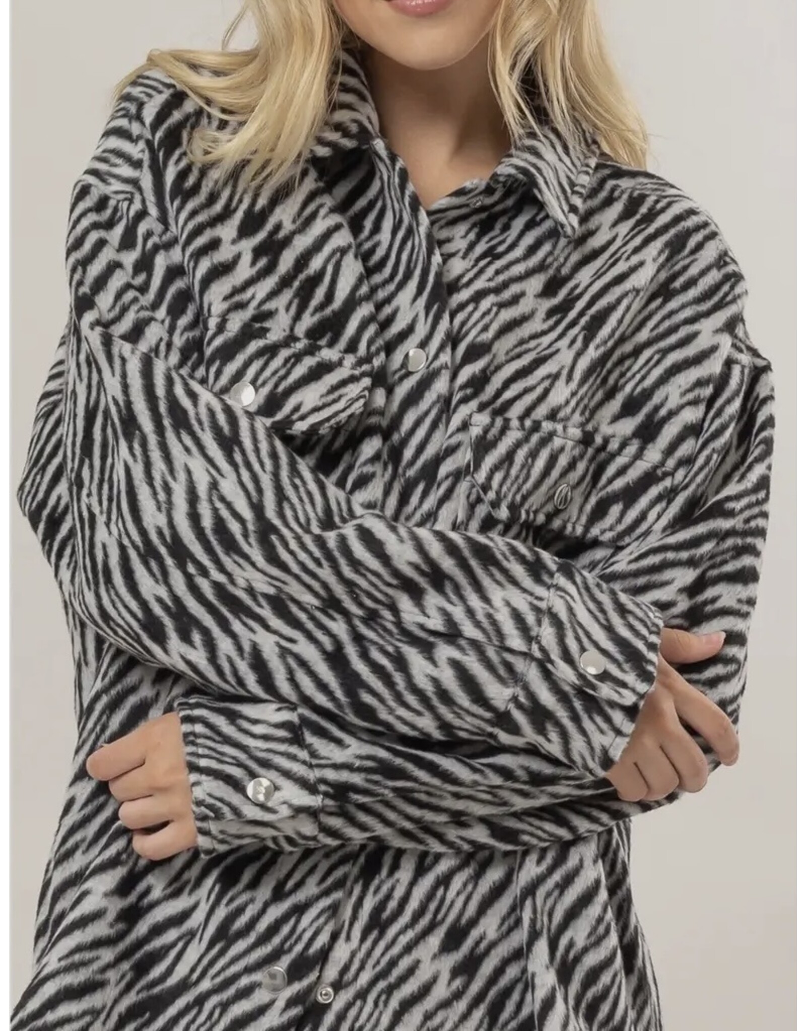 Hyfve Zebra Oversized Shacket