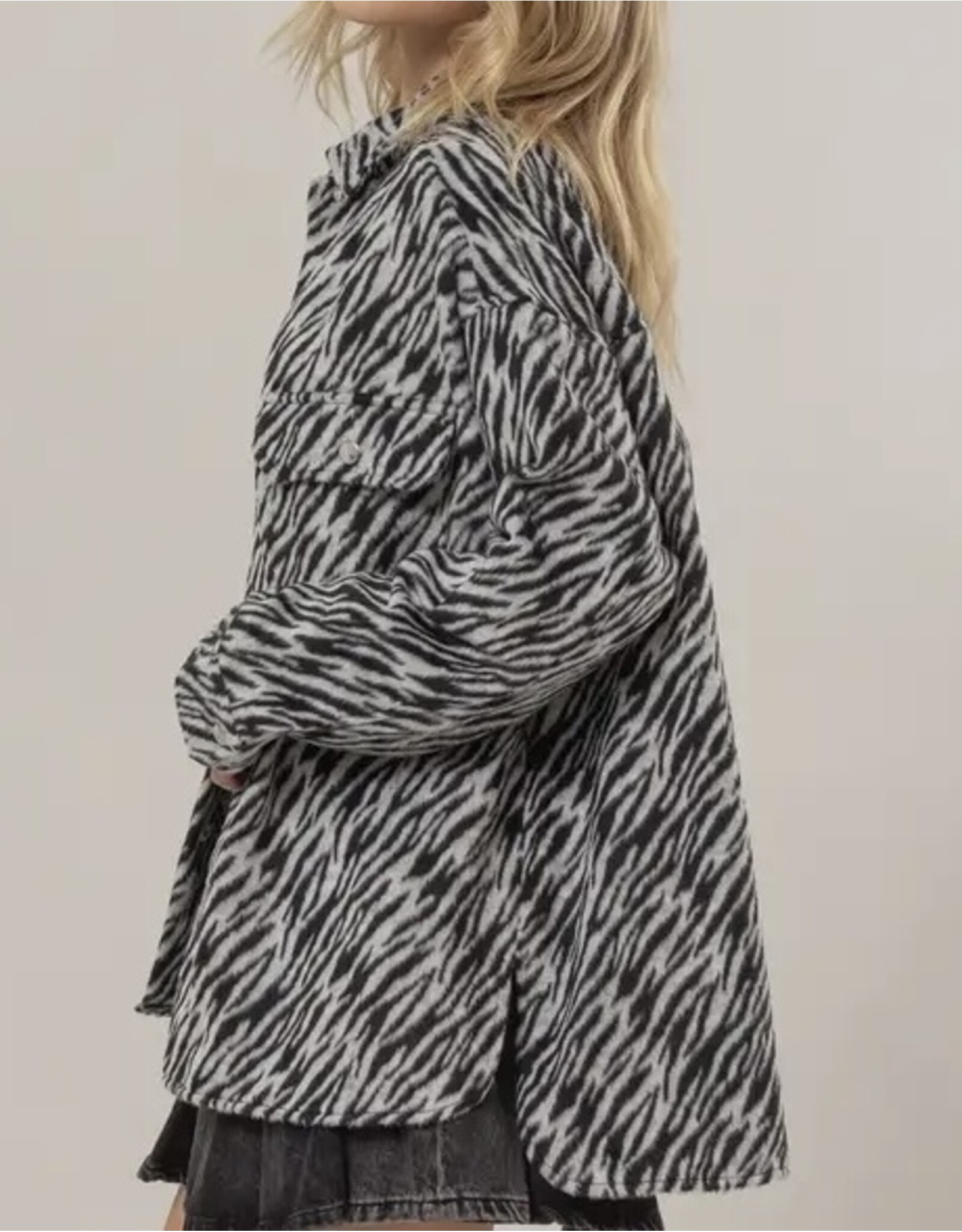 Hyfve Zebra Oversized Shacket