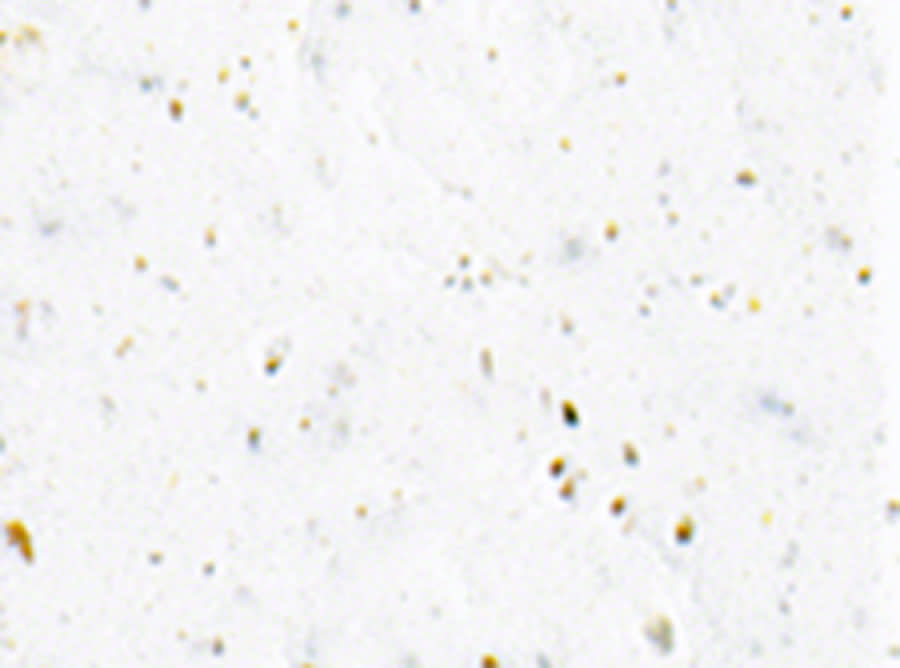 cinelli fluo bar tape