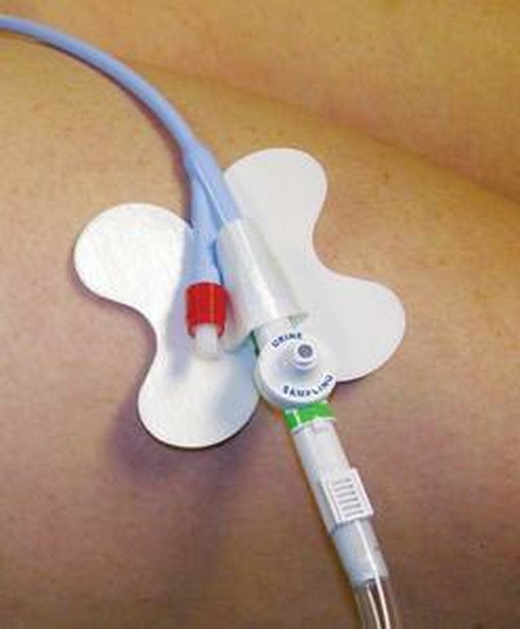 M.C.Johnson Cath•Secure® | M.C. Johnson