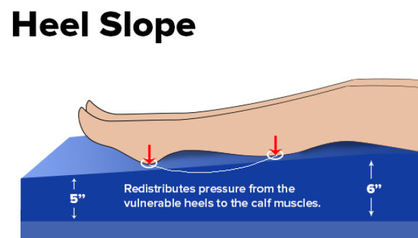 DRV-Drive Medical Gravity 9 Premium Long Term Care Pressure Redistribution Mattress 80"