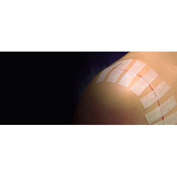 3M 3M Steri-Strip Adhesive Skin Closures 1/4" X 3" 50/Bx