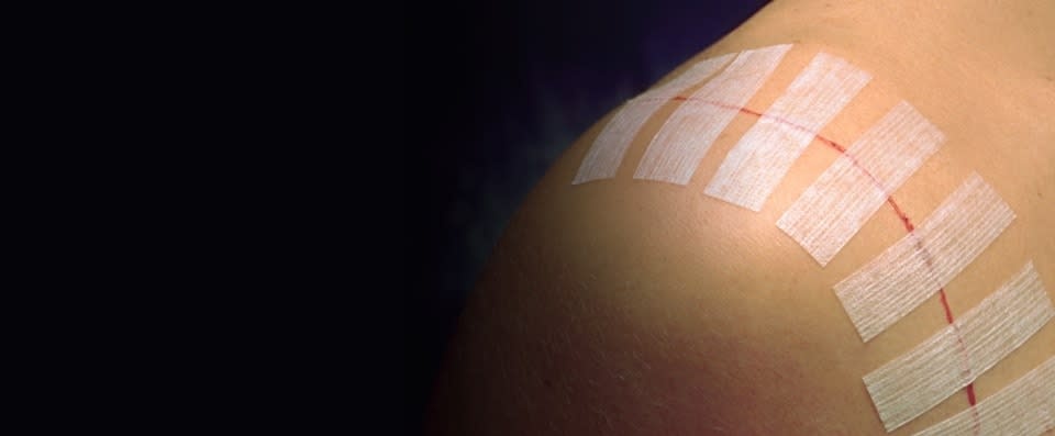 3M-3M 3M Steri-Strip Adhesive Skin Closures 1/4" X 3" 50/Bx