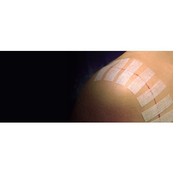 3M 3M Steri-Strip Adhesive Skin Closures 1/4" X 3"