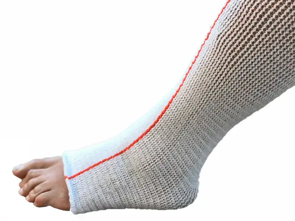 CD-COMPRESSION DYNAMICS Compression Dynamics Edemawear Lite Lymphedema Stockinet Medium, Max Limb Circumference 90cm (24") Length 86cm (34") For Tender Skin, Orange Stripe, Longitudinal Compression, Latex-Free