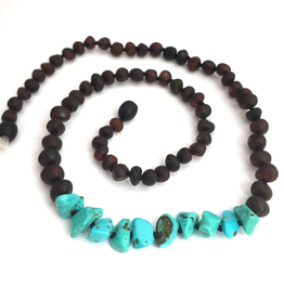 Momma Goose Momma Goose Baltic Amber Necklace Adult Raw