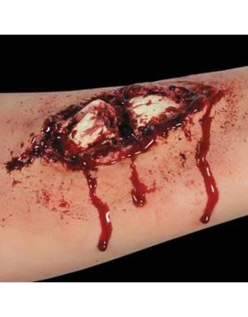 Latex App - Broken Bone