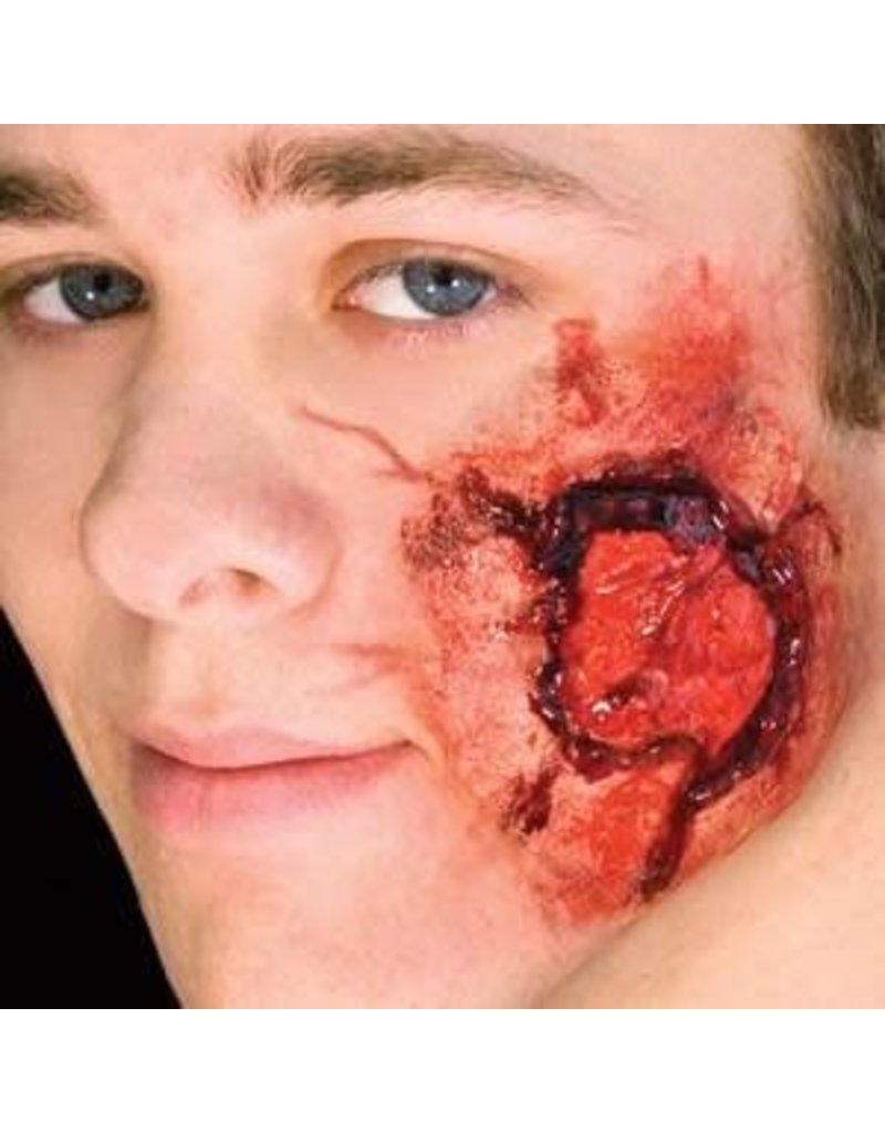 Latex App - Open Wound