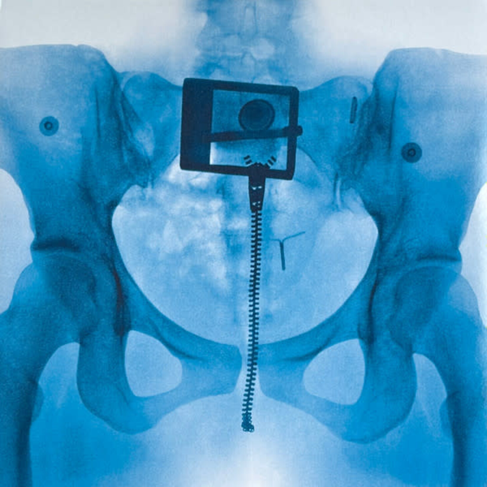 [New Vinyl] Lorde: Virgin (Exclusive, Pictures Disc, w/ booklette) [UNIVERSAL}