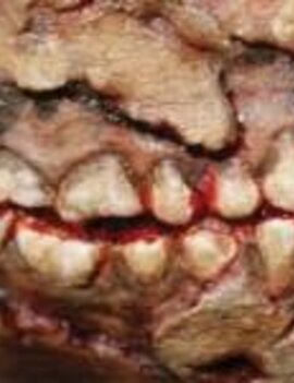 Zombie Cheek Decay – 3D FX Transfers Zombie Cheek Decay – 3D FX Transfers