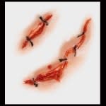 Stitches – 3D FX Transfers