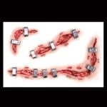 Staplestein – 3D FX Transfers