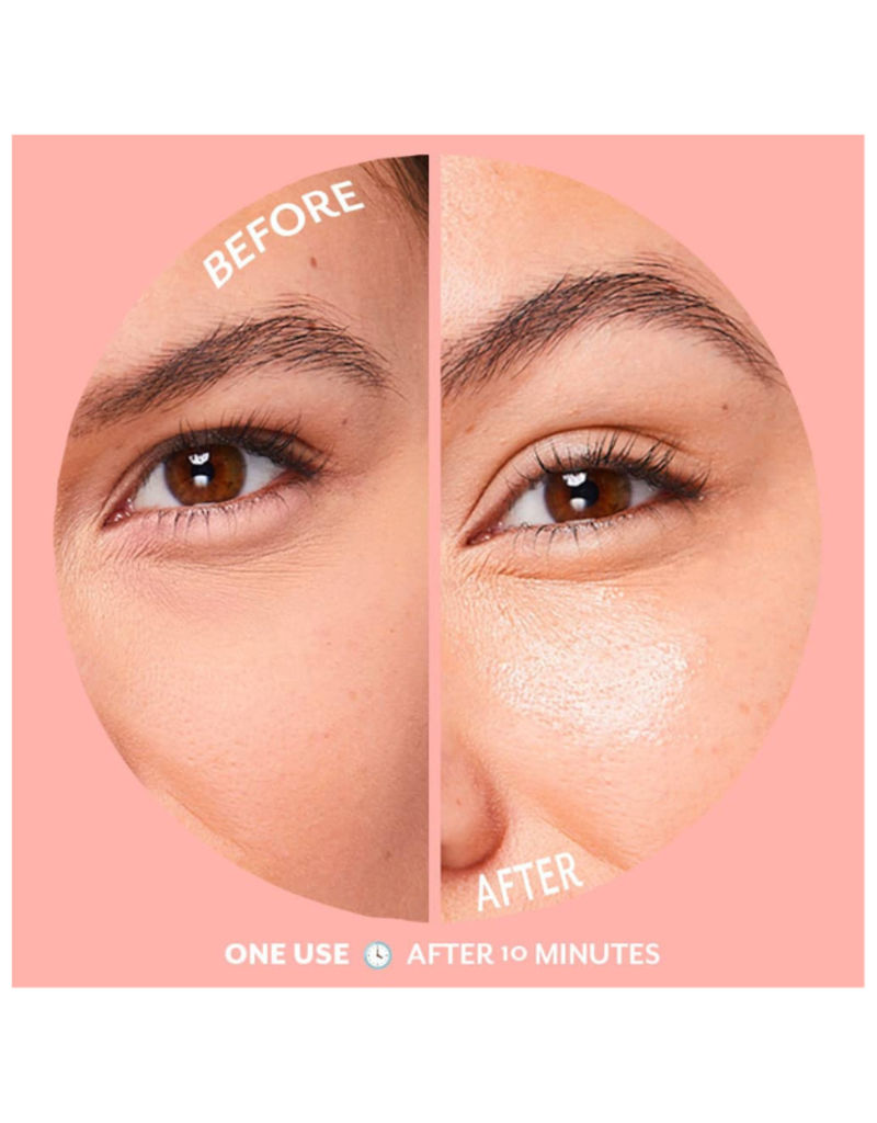 patchology Serve Chilled Bubbly Eye Gels 5 pairs by Patchology