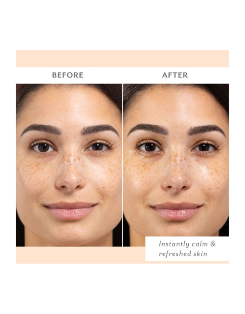 patchology Calm & Protect Mist by Patchology